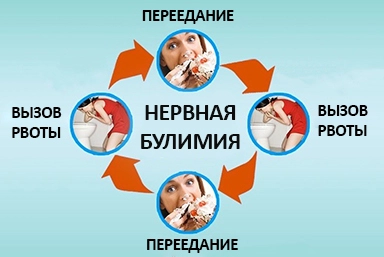 Лечение булимии в Калачинске